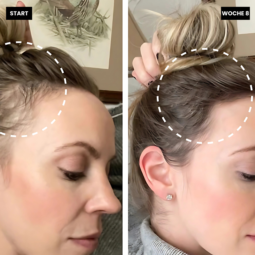 Straithair - 3 in 1 Massagebürste